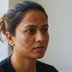 Acne - Pigmentation भारत में मुंहासे और पिग्मेंटेशन क्यों है बड़ी समस्या ?